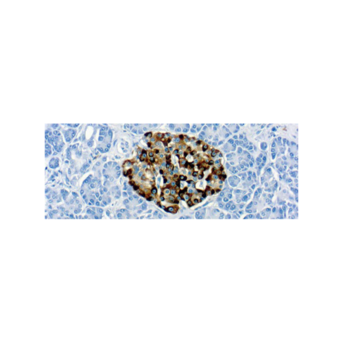 Chromogranin Chromogranin