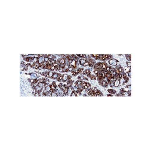 Citoqueratina 19 (A53-BA2.26)