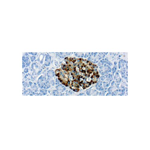 Diagnostic BioSystems 6616 Owens Drive Pleasanton, CA, 94588 Tel: (925) 484 3350 www.dbiosys.com Emergo Europe Prinsessegracht 20 2514 AP, The Hague The Netherlands Tel: (31) (0) 70 345 8570 Chromogranin A (LK2H10) Diagnostic BioSystems 6616 Owens Drive Pleasanton, CA, 94588 Tel: (925) 484 3350 www.dbiosys.com Emergo Europe Prinsessegracht 20 2514 AP, The Hague The Netherlands Tel: (31) (0) 70 345 8570 Chromogranin A (LK2H10)