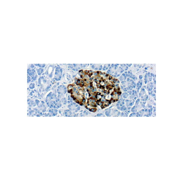Diagnostic BioSystems 6616 Owens Drive Pleasanton, CA, 94588 Tel: (925) 484 3350 www.dbiosys.com Emergo Europe Prinsessegracht 20 2514 AP, The Hague The Netherlands Tel: (31) (0) 70 345 8570 Chromogranin A (LK2H10) Diagnostic BioSystems 6616 Owens Drive Pleasanton, CA, 94588 Tel: (925) 484 3350 www.dbiosys.com Emergo Europe Prinsessegracht 20 2514 AP, The Hague The Netherlands Tel: (31) (0) 70 345 8570 Chromogranin A (LK2H10)