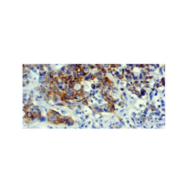 Cytokeratin 7 Cytokeratin 7