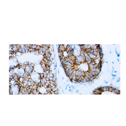 E-Cadherin (SPM471) E-Cadherin (SPM471)