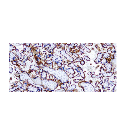 (EGFR) -31G7 (EGFR) -31G7