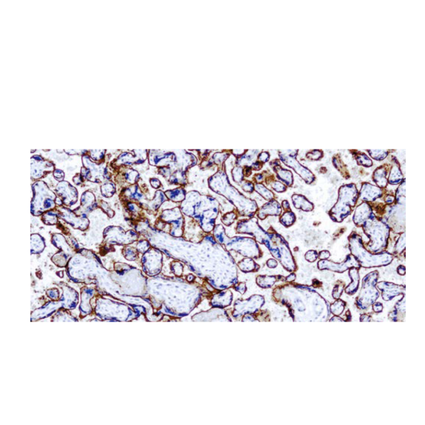 (EGFR) -31G7 (EGFR) -31G7