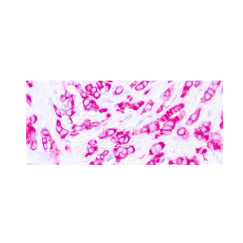 Epithelial Membrane Antigen (EMA) E29 Epithelial Membrane Antigen (EMA) E29