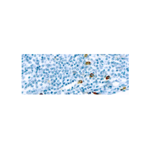 Mast Cell Chymase Mast Cell Chymase
