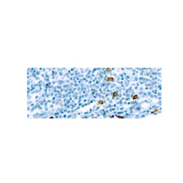 Mast Cell Chymase Mast Cell Chymase