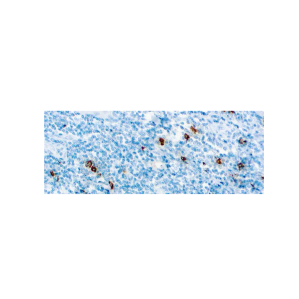 Mast Cell Tryptase Mast Cell Tryptase