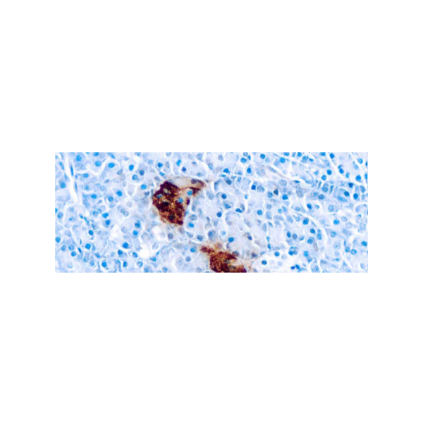 Pancreatic Polypeptide Pancreatic Polypeptide