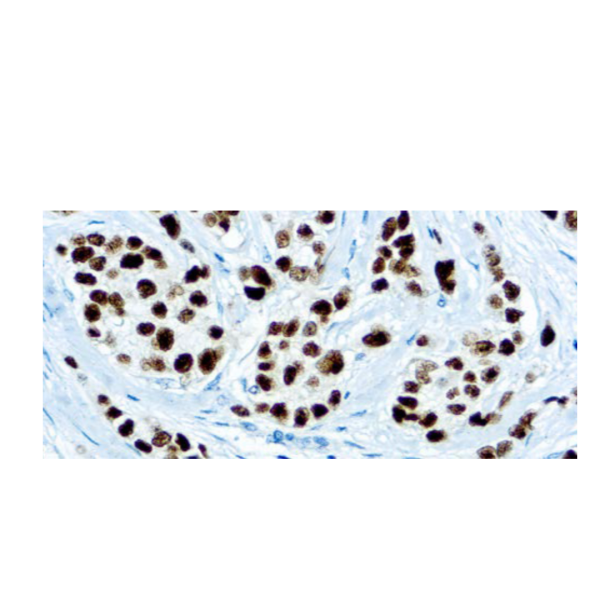 Progesterone Receptor (SP2) Progesterone Receptor (SP2)