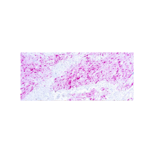 S-100 Protein S-100 Protein
