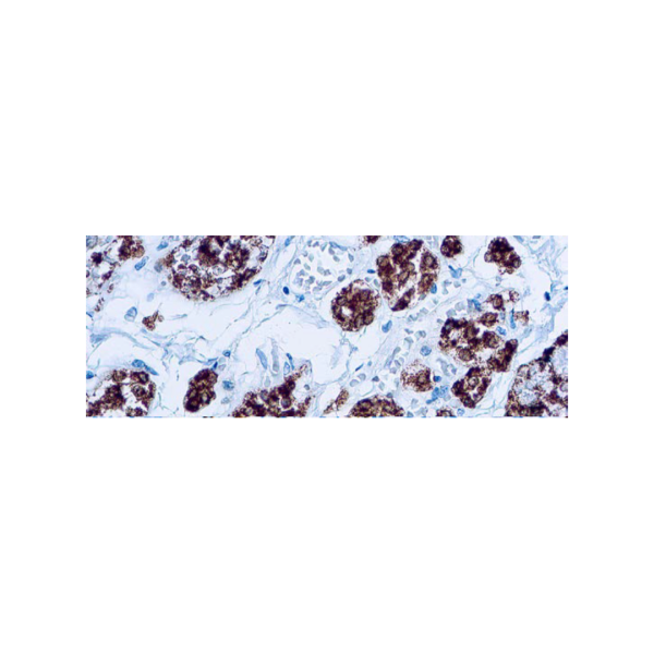 Thyroid Peroxidase Thyroid Peroxidase