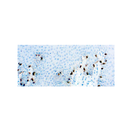 Tyrosinase, Melanoma Marker Tyrosinase, Melanoma Marker