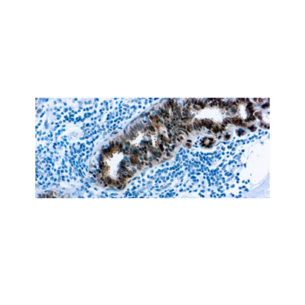 Proteína de Choque Térmico Proteína de Choque Térmico