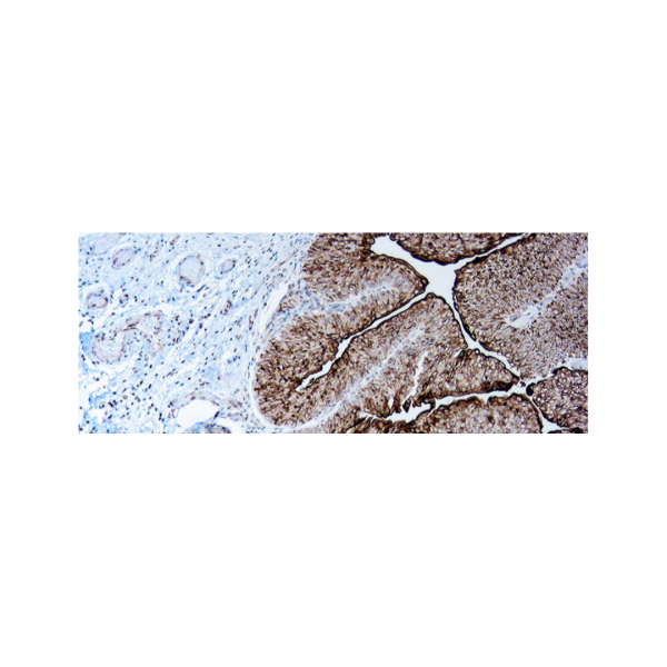 Uroplakin III Uroplakin III
